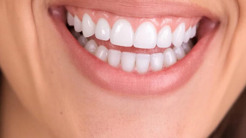 Эпоха Сияющих Улыбок: Путь к Совершенству с Винирами из Сверхпрочной Керамики